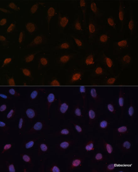 Immunofluorescence analysis of L929 cells using STAR Polyclonal Antibody at dilution of  1:100 (40x lens). Blue: DAPI for nuclear staining.