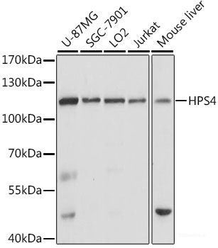 Immunofluorescence analysis of U-2 OS cells using SUPT6H Polyclonal Antibody at dilution of  1:100. Blue: DAPI for nuclear staining.