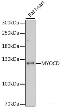 Immunofluorescence analysis of HeLa cells using TBP Polyclonal Antibody at dilution of  1:100 (40x lens). Blue: DAPI for nuclear staining.