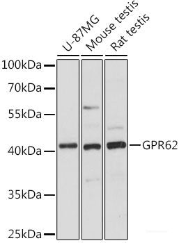 Immunohistochemistry of paraffin-embedded Rat spleen using CD11A Polyclonal Antibody at dilution of  1:100 (40x lens).