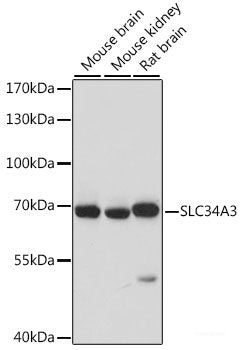 Immunofluorescence analysis of HeLa cells using FXR1 Polyclonal Antibody at dilution of  1:100. Blue: DAPI for nuclear staining.