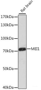 Immunofluorescence analysis of RAW264.7 cells using PD-L1 Polyclonal Antibody at dilution of  1:100. Blue: DAPI for nuclear staining.