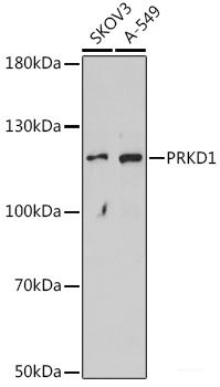 Immunohistochemistry of paraffin-embedded Rat ovary using PLAA Polyclonal Antibody at dilution of  1:100 (40x lens).