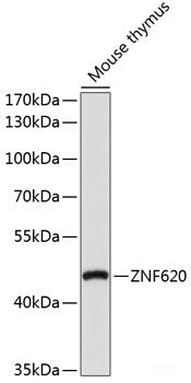 Immunohistochemistry of paraffin-embedded Rat heart using KATNA1 Polyclonal Antibody at dilution of  1:100 (40x lens).