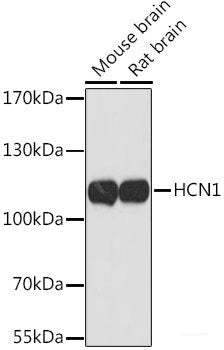 Immunofluorescence analysis of HeLa cells using BAZ1A Polyclonal Antibody at dilution of  1:100 (40x lens). Blue: DAPI for nuclear staining.