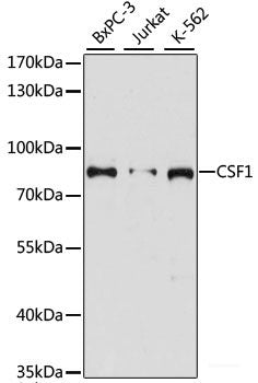 Immunofluorescence analysis of L929 cells using SEPT3 Polyclonal Antibody at dilution of  1:100. Blue: DAPI for nuclear staining.