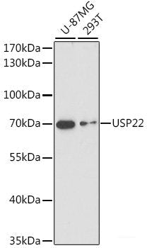 Immunofluorescence analysis of Rat brain using KIF17 Polyclonal Antibody at dilution of  1:100. Blue: DAPI for nuclear staining.