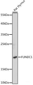 Immunohistochemistry of paraffin-embedded Human liver cancer using SLAMF7 Polyclonal Antibody at dilution of  1:100 (40x lens).