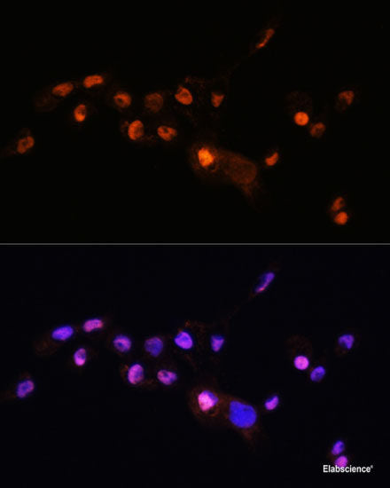 Immunofluorescence analysis of C6 cells using ACBD3 Polyclonal Antibody at dilution of  1:100. Blue: DAPI for nuclear staining.