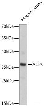 Immunofluorescence analysis of HeLa cells using CA9 Polyclonal Antibody at dilution of  1:100. Blue: DAPI for nuclear staining.