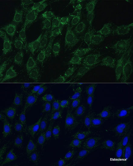 Immunohistochemistry of paraffin-embedded Human placenta using DTNBP1 Polyclonal Antibody at dilution of  1:100 (40x lens).