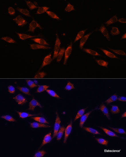 Immunohistochemistry of paraffin-embedded Human liver cancer using UGT1A9 Polyclonal Antibody at dilution of  1:200 (40x lens).