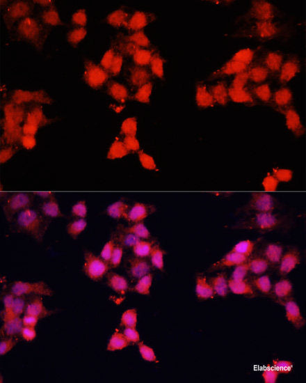 Immunofluorescence analysis of HeLa cells using HRNR Polyclonal Antibody at dilution of  1:100 (40x lens). Blue: DAPI for nuclear staining.