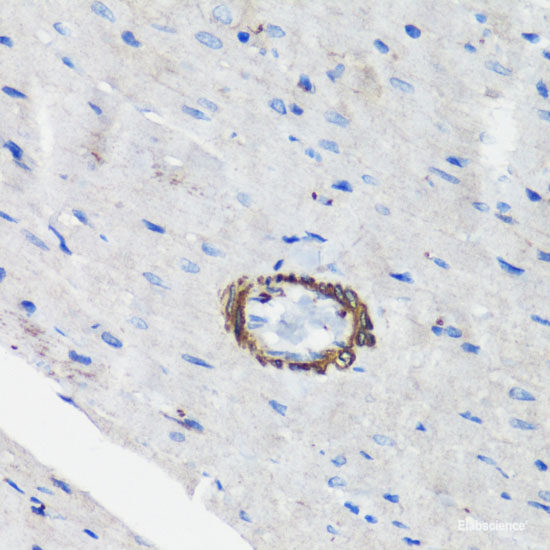 Immunohistochemistry of paraffin-embedded Human placenta using TXNRD1 Polyclonal Antibody at dilution of  1:100 (40x lens).