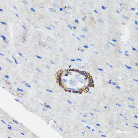 Immunohistochemistry of paraffin-embedded Human placenta using TXNRD1 Polyclonal Antibody at dilution of  1:100 (40x lens).