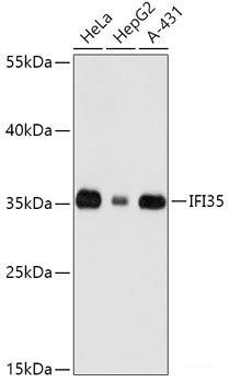 Immunohistochemistry of paraffin-embedded Human colon using TGFB1 Polyclonal Antibody at dilution of  1:100 (40x lens).