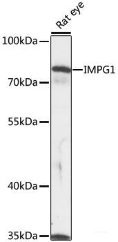 Immunohistochemistry of paraffin-embedded Rat brain using PDPK1 Polyclonal Antibody at dilution of  1:200 (40x lens).