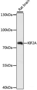 Immunohistochemistry of paraffin-embedded Rat kidney using UGT2B15 Polyclonal Antibody at dilution of  1:100 (40x lens).