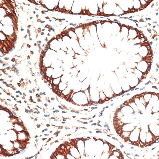 Immunofluorescence analysis of L929 cells using DRP1 Polyclonal Antibody at dilution of  1:100 (40x lens). Blue: DAPI for nuclear staining.