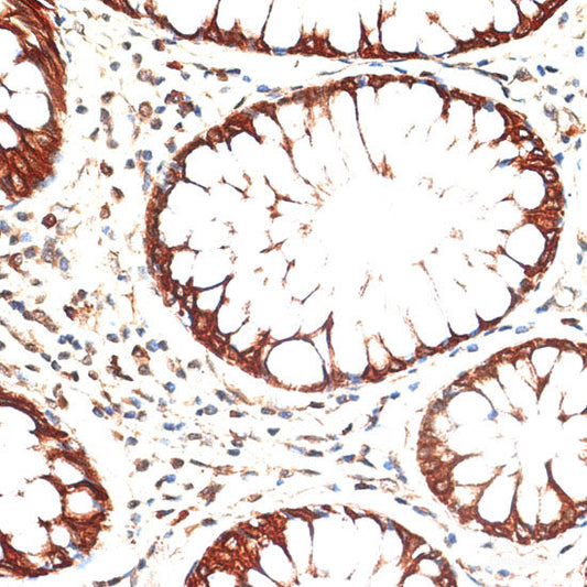 Immunofluorescence analysis of L929 cells using DRP1 Polyclonal Antibody at dilution of  1:100 (40x lens). Blue: DAPI for nuclear staining.