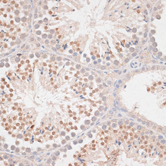Immunohistochemistry of paraffin-embedded Rat brain using ATXN2 Polyclonal Antibody at dilution of  1:100 (40x lens).