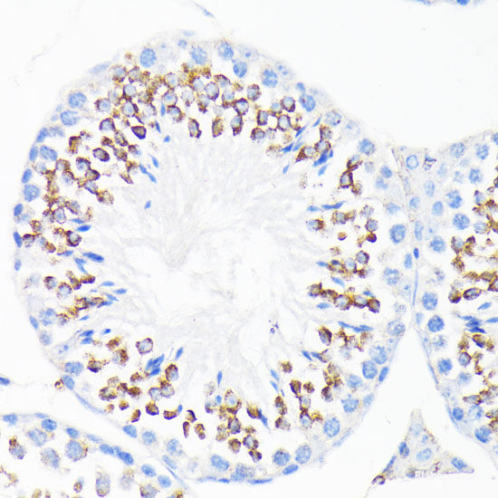 Immunohistochemistry of paraffin-embedded Human placenta using ASC / TMS1 Polyclonal Antibody at dilution of  1:100 (40x lens).