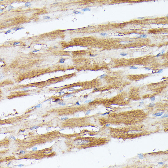Immunohistochemistry of paraffin-embedded Rat lung using Decorin Polyclonal Antibody at dilution of  1:200 (40x lens).
