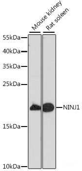 Immunofluorescence analysis of Rat spleen using CD70 Polyclonal Antibody at dilution of  1:100 (40x lens). Blue: DAPI for nuclear staining.