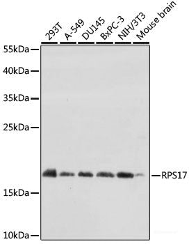 Immunofluorescence analysis of Rat heart using TTN Polyclonal Antibody at dilution of  1:100. Blue: DAPI for nuclear staining.
