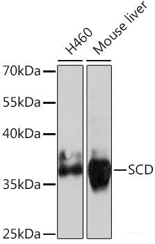 Immunofluorescence analysis of U-251 MG cells using ABCA2 Polyclonal Antibody at dilution of  1:100 (40x lens). Blue: DAPI for nuclear staining.