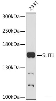 Immunofluorescence analysis of C6 cells using IL18 Polyclonal Antibody at dilution of  1:100. Blue: DAPI for nuclear staining.
