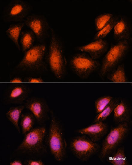 Immunohistochemistry of paraffin-embedded Human colon carcinoma using SNIP1 Polyclonal Antibody at dilution of  1:100 (40x lens).