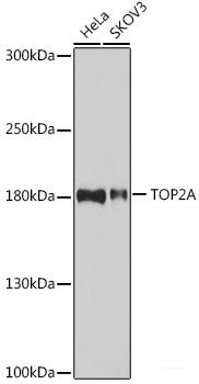 Immunohistochemistry of paraffin-embedded Human liver using APOD Polyclonal Antibody at dilution of  1:100 (40x lens).