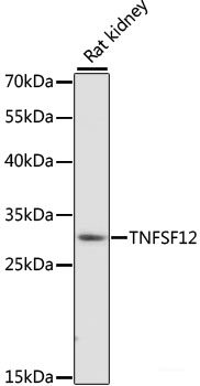 Immunohistochemistry of paraffin-embedded Human appendix using XRCC4 Polyclonal Antibody at dilution of  1:100 (40x lens).