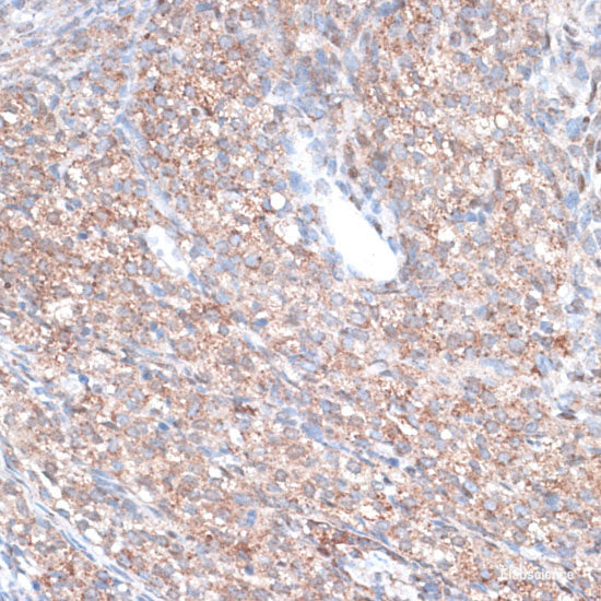 Immunofluorescence analysis of U2OS cells using KAT5 Polyclonal Antibody at dilution of  1:100. Blue: DAPI for nuclear staining.
