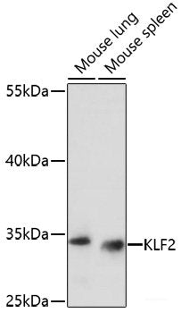 Immunohistochemistry of paraffin-embedded Human tonsil using CASQ1 Polyclonal Antibody at dilution of  1:100 (40x lens).