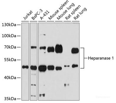 Immunohistochemistry of paraffin-embedded Mouse heart using CASQ2 Polyclonal Antibody at dilution of  1:100 (40x lens).