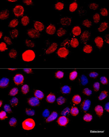 Immunohistochemistry of paraffin-embedded Human mammary cancer using CCNB1 Polyclonal Antibody at dilution of  1:100 (40x lens).