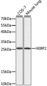 Immunofluorescence analysis of Rat spleen using CD70 Polyclonal Antibody at dilution of  1:100. Blue: DAPI for nuclear staining.