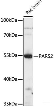 Immunohistochemistry of paraffin-embedded Human breast cancer using DMP1 Polyclonal Antibody at dilution of  1:100 (40x lens).
