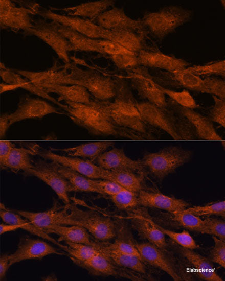 Immunofluorescence analysis of HeLa cells using EGFR Polyclonal Antibody at dilution of  1:100. Blue: DAPI for nuclear staining.