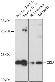 Immunofluorescence analysis of U-2 OS cells using ACSL4 Polyclonal Antibody at dilution of  1:100. Blue: DAPI for nuclear staining.