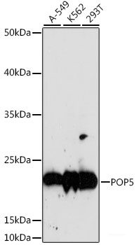 Immunohistochemistry of paraffin-embedded Human lung cancer using NR5A2 Polyclonal Antibody at dilution of  1:100 (40x lens).