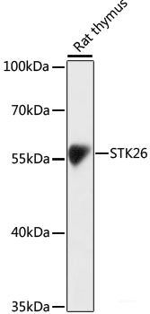 Immunohistochemistry of paraffin-embedded Human lung cancer using GAB1 Polyclonal Antibody at dilution of  1:100 (40x lens).