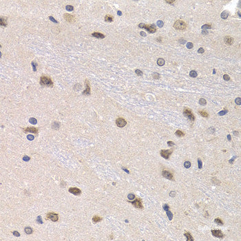 Immunohistochemistry of paraffin-embedded Mouse brain using GAP43 Polyclonal Antibody at dilution of  1:100 (40x lens).