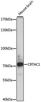 Immunofluorescence analysis of L-929 cells using GLI2 Polyclonal Antibody at dilution of  1:100. Blue: DAPI for nuclear staining.