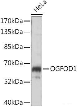 Immunohistochemistry of paraffin-embedded Human liver cancer using HIF1A Polyclonal Antibody at dilution of  1:200 (40x lens).
