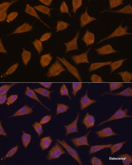 Immunohistochemistry of paraffin-embedded Human colon using HMGCR Polyclonal Antibody at dilution of  1:200 (40x lens).