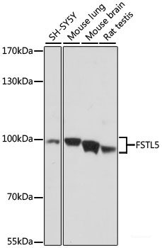 Immunofluorescence analysis of NIH/3T3 cells using HMGCR Polyclonal Antibody at dilution of  1:100. Blue: DAPI for nuclear staining.