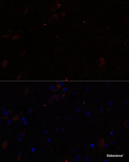 Immunohistochemistry of paraffin-embedded Rat heart using CD59 Polyclonal Antibody at dilution of  1:100 (40x lens).